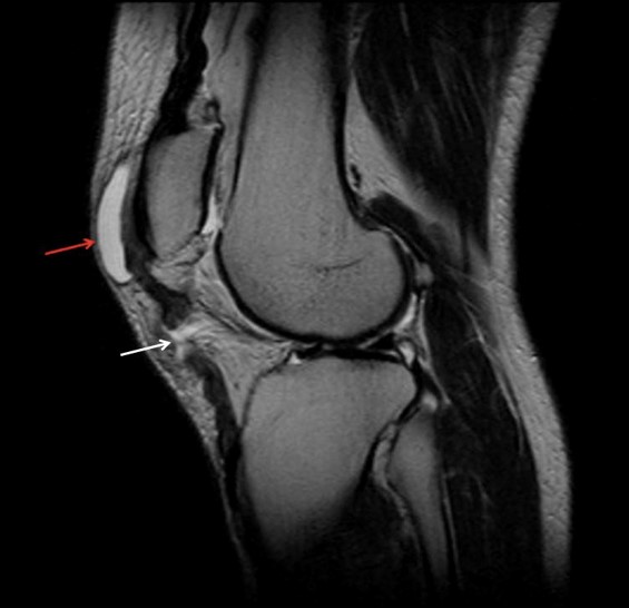 https://rodillaclinic.com/wp-content/uploads/2023/07/traumatologia-ruptura-tendon-rotuliano.jpg